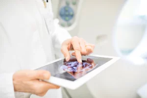 Eine Ärztin mit einem iPad in der Hand, auf dem ein CT eines Gehirns zu sehen ist